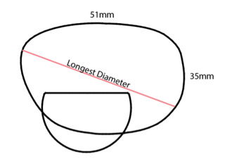 Measuring Frame ED - Longest Diameter