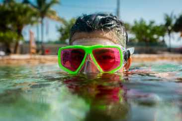 SeaVision Offers a wide range of lens filters to enhance your patient's underwater experience