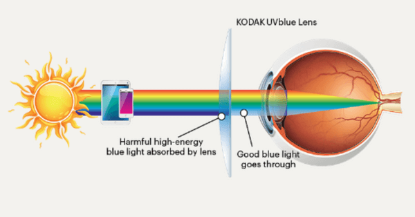 KODAK UVBlue lenses offer harmful blue light protection with 100% UV filtration